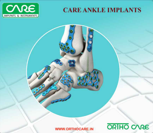 Ankle Catalogue