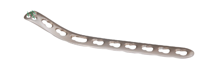 Clavicle Hook