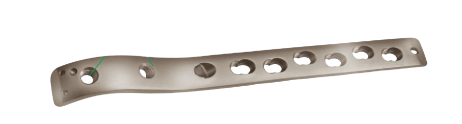 Clavicle Hook