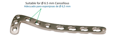 Locking Plate Proximal Lateral Tibia